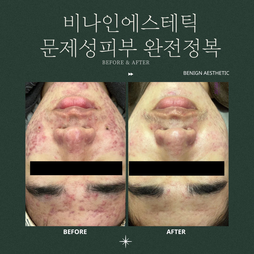 비나인에스테틱 대표 이미지