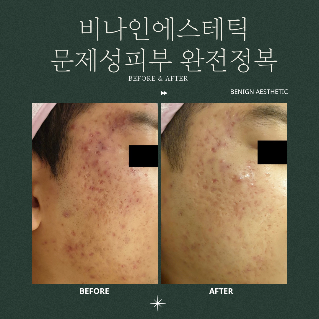 비나인에스테틱 대표 이미지