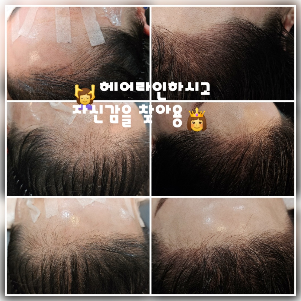 하복희의자연미인