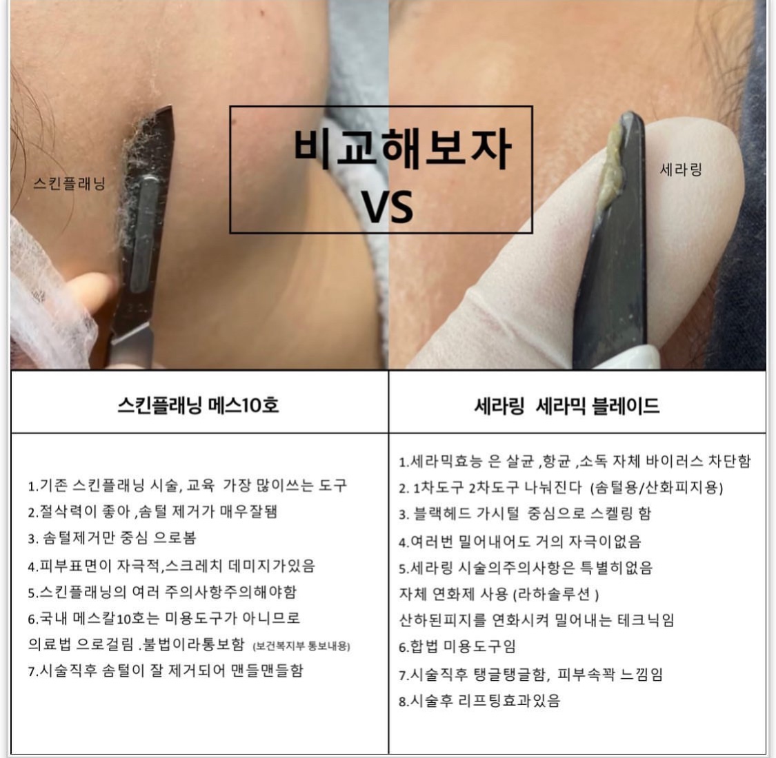 무아 플레이스 강남 피부관리 스킨플래닝 플라즈마