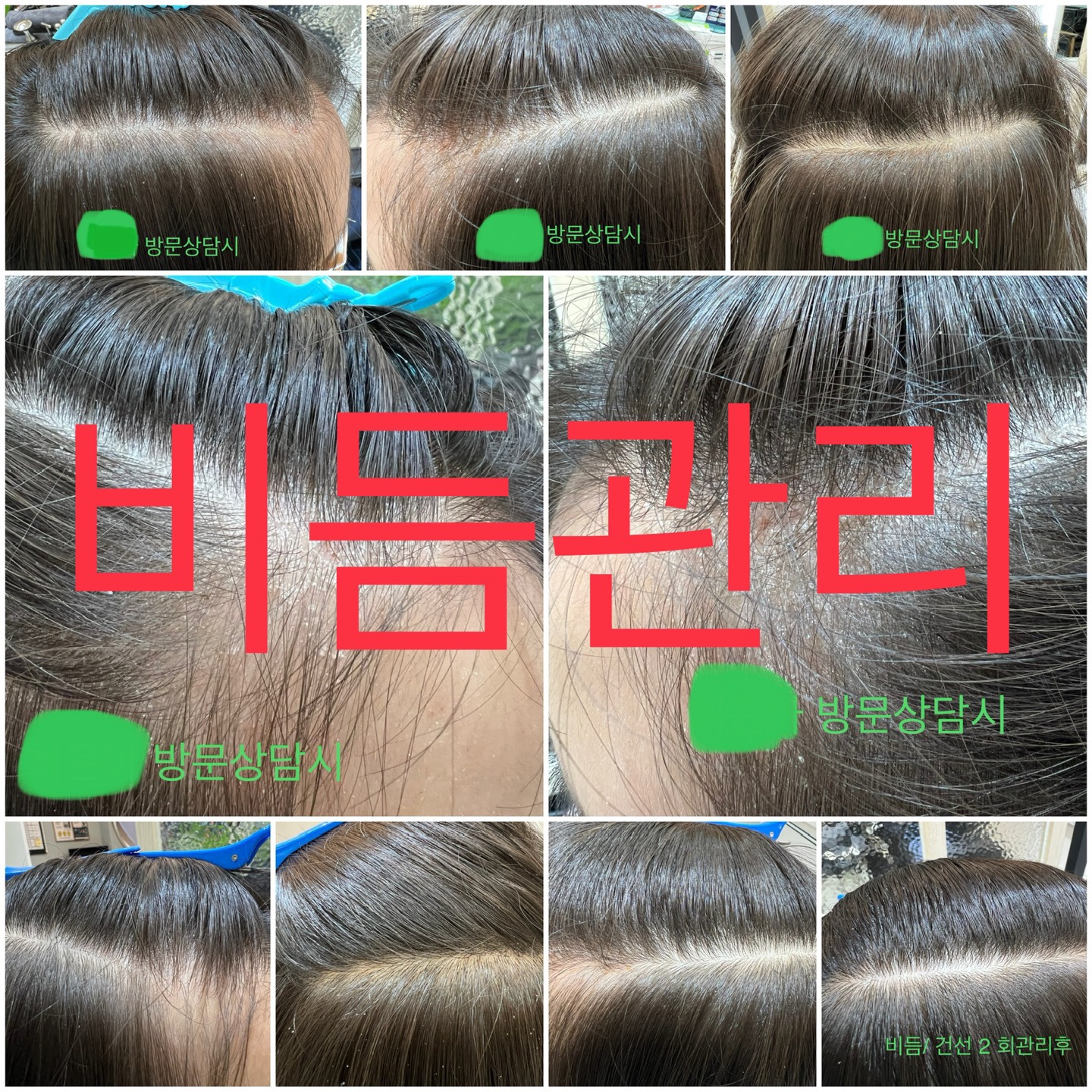 닥터스칼프 원주혁신점