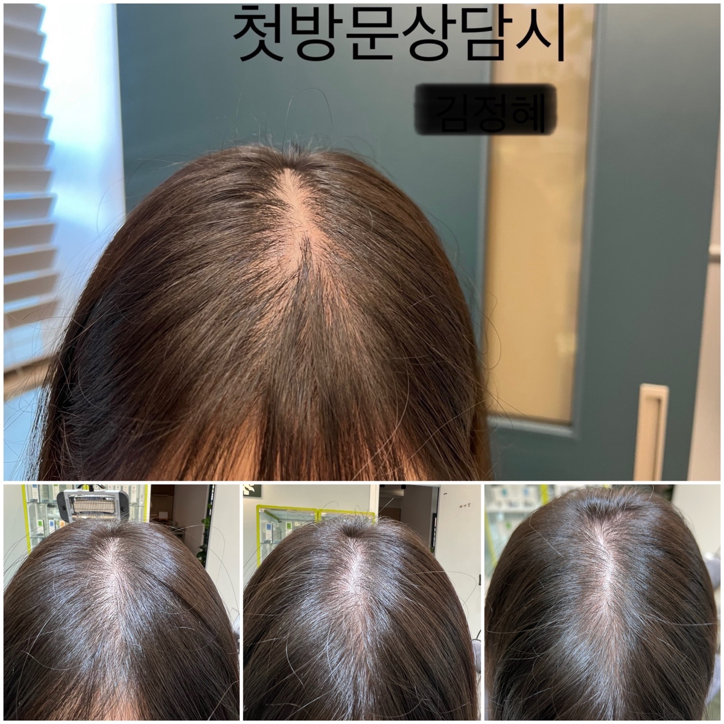 닥터스칼프 원주혁신점
