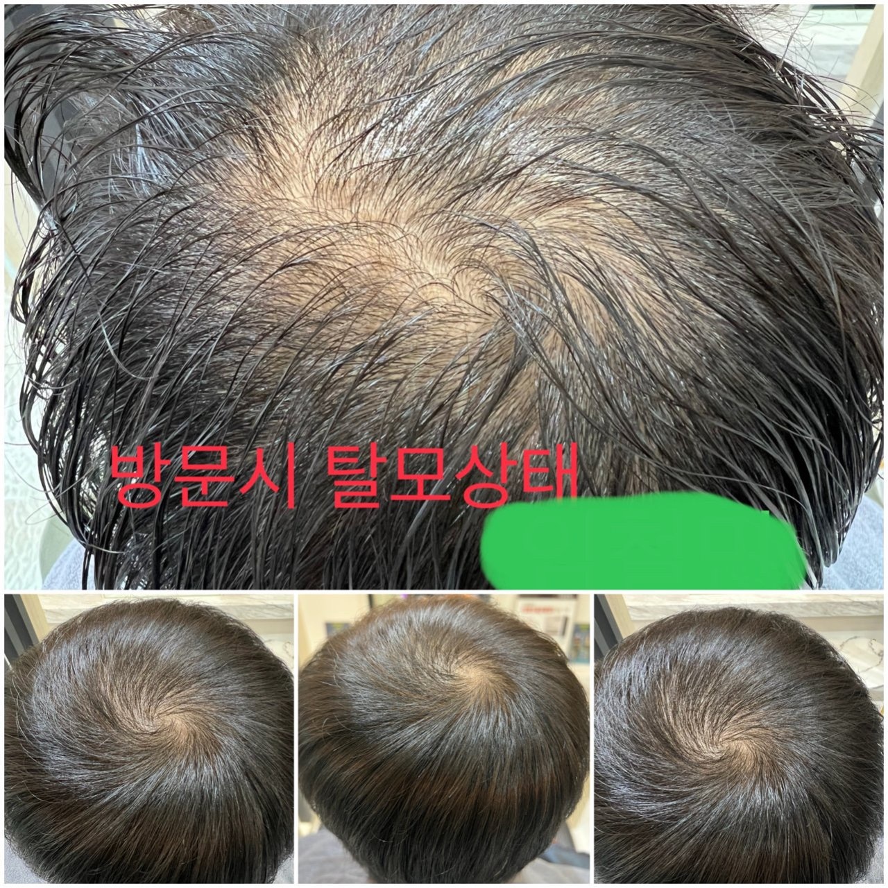 닥터스칼프 원주혁신점