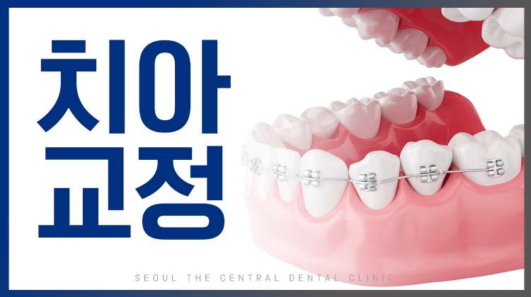 치아교정상담 대표사진