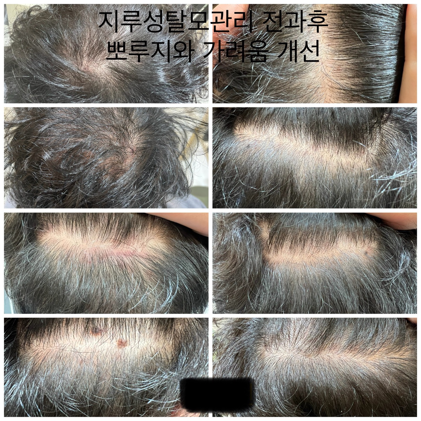 닥터스칼프 원주혁신점