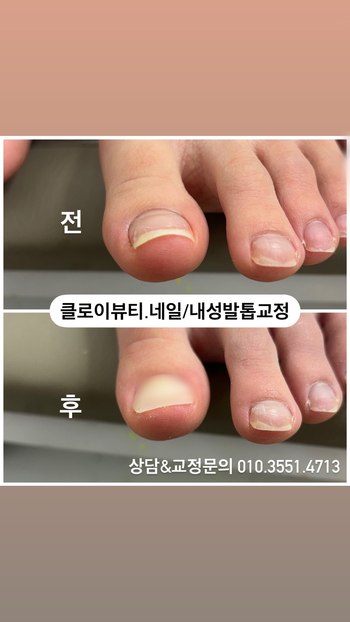 클로이뷰티네일