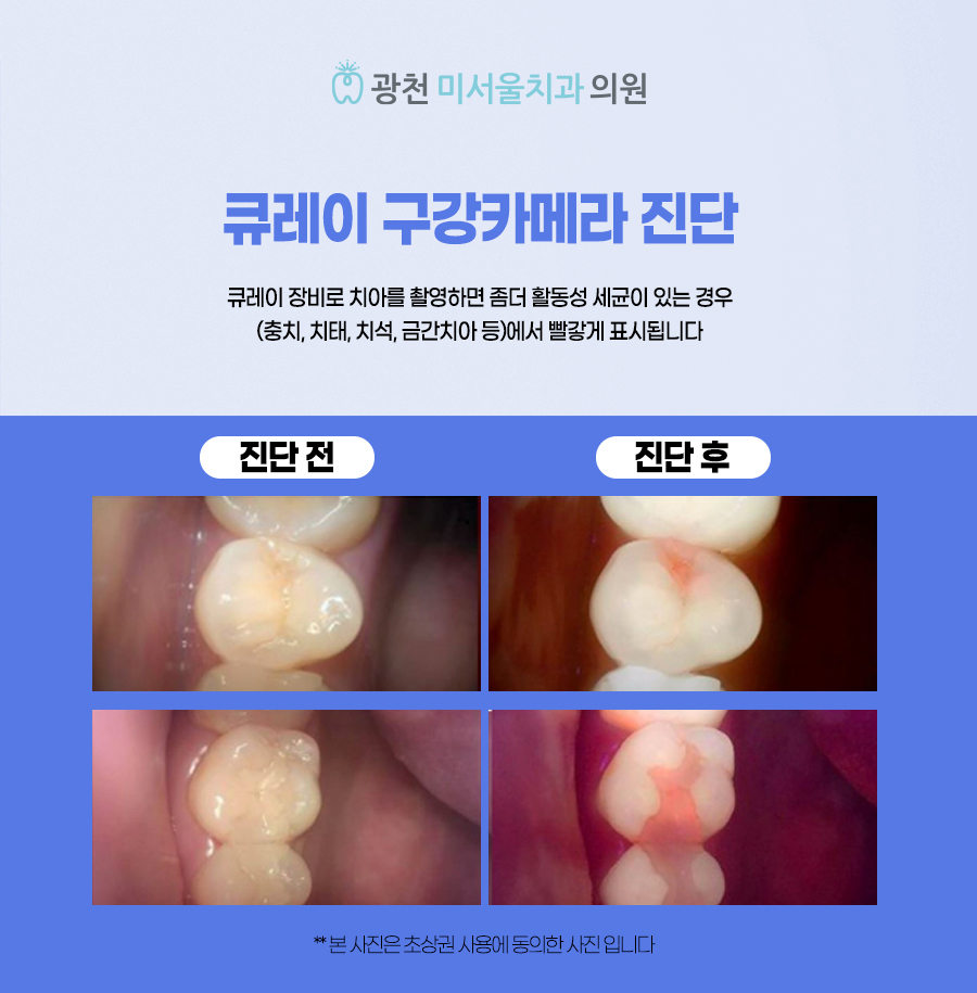 광천 미서울 치과의원 대표 이미지