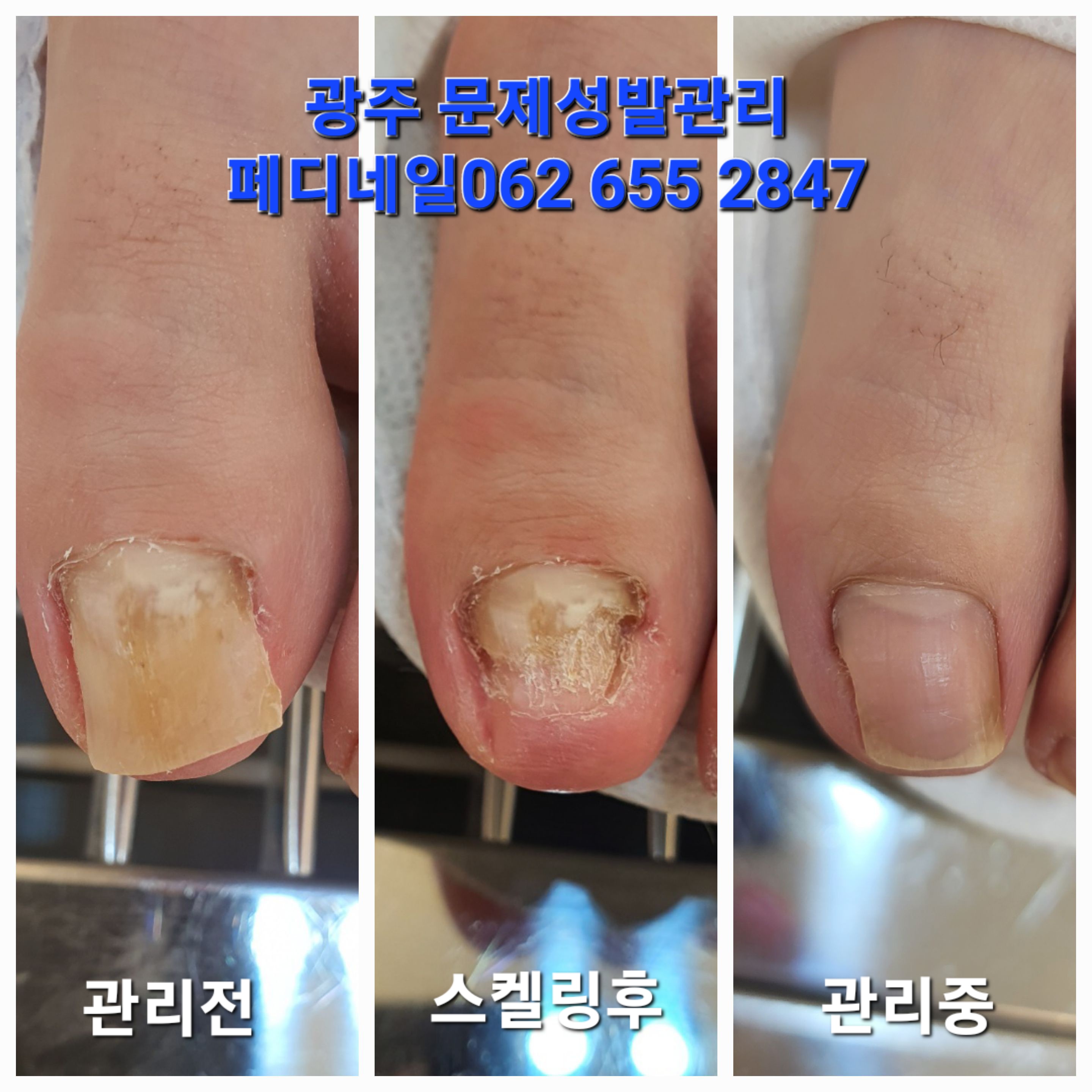 뷰티업라이프 페디네일 광주본점