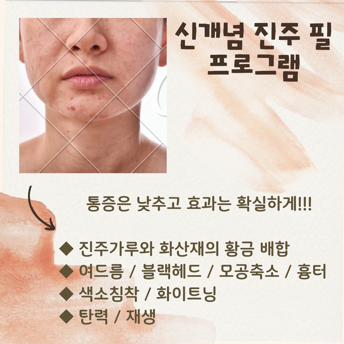 라미스킨케어