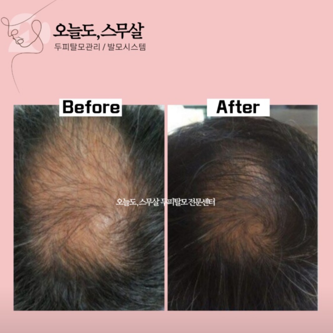 오늘도스무살 대구점