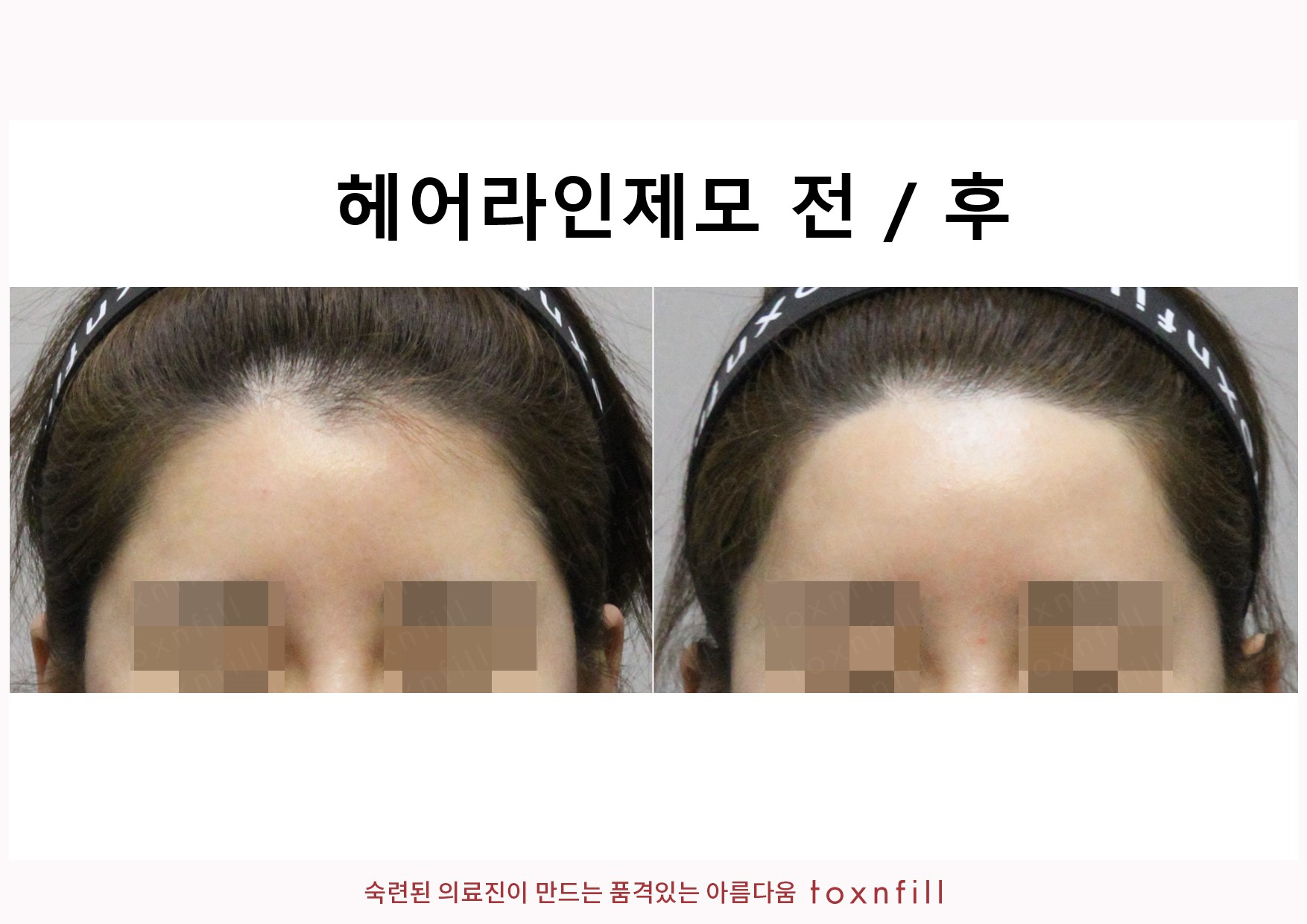 분당 톡스앤필의원 대표 이미지