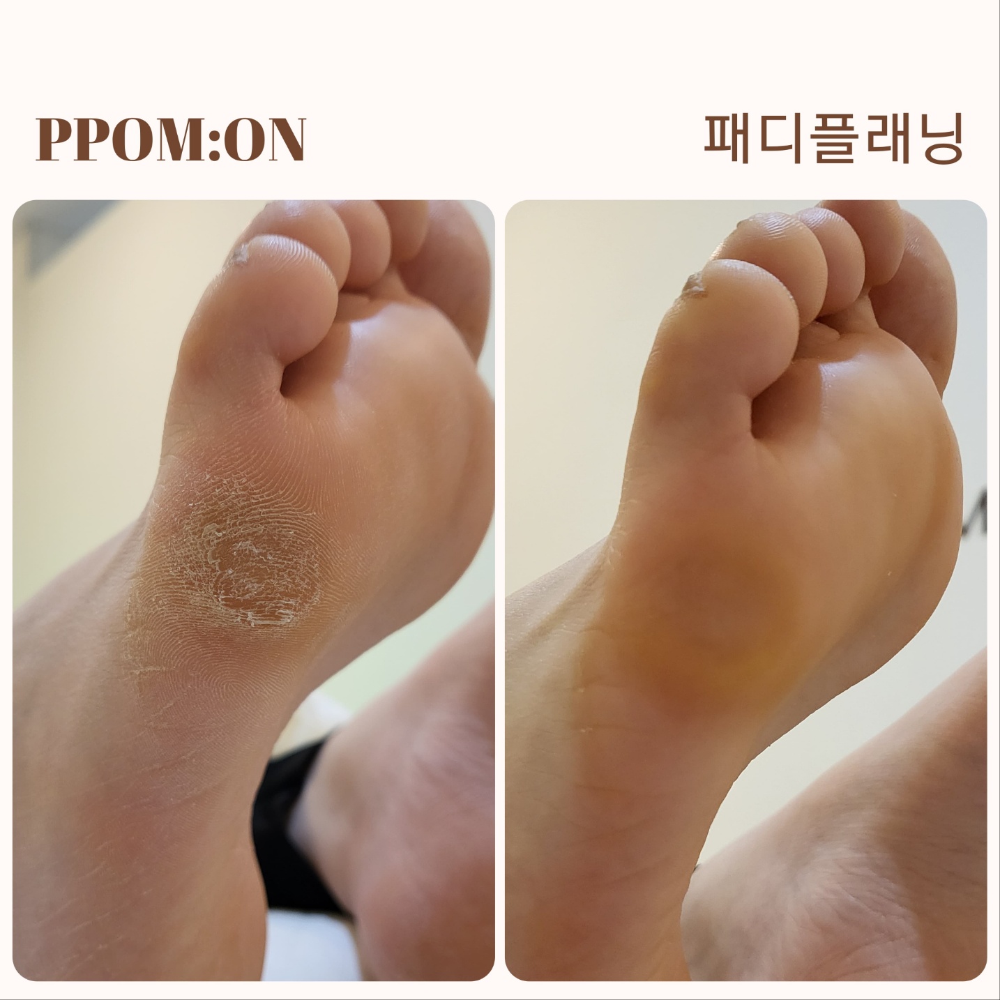 뽐온뷰티 대구본점