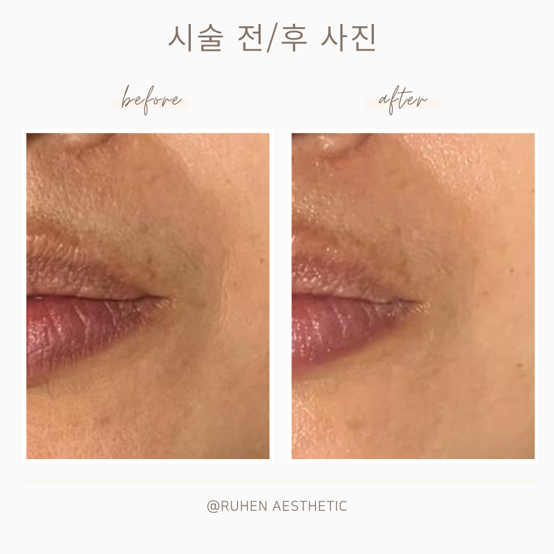루엔에스테틱