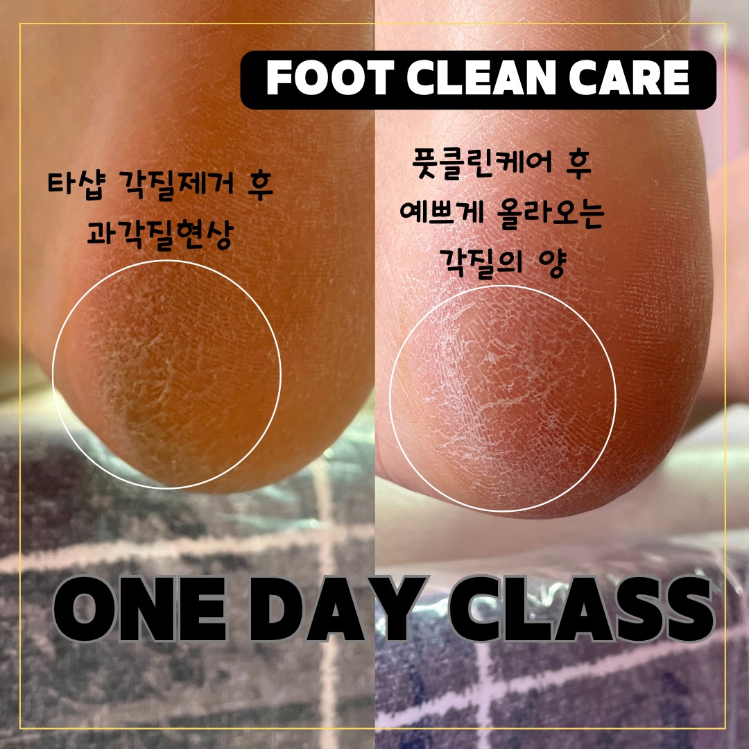 앙크미뷰티