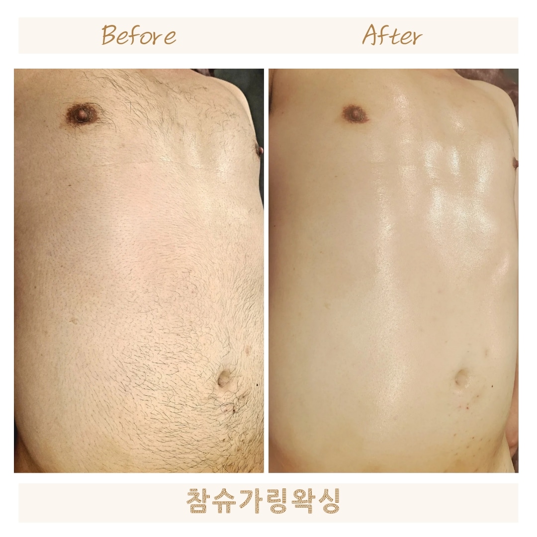 참슈가링왁싱