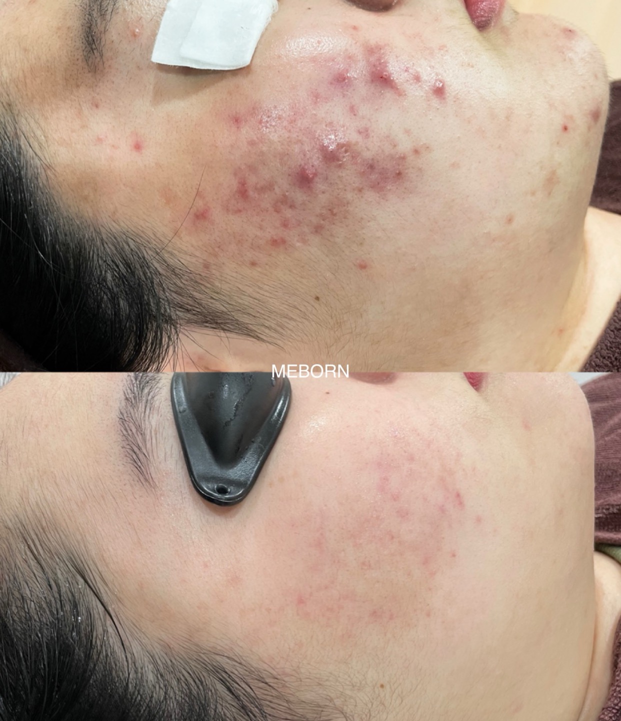 미본에스테틱 대표 이미지