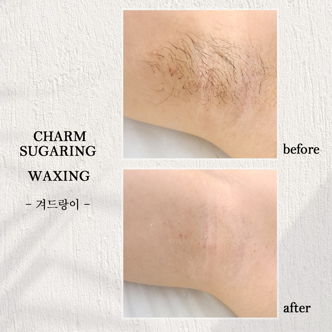 참슈가링왁싱