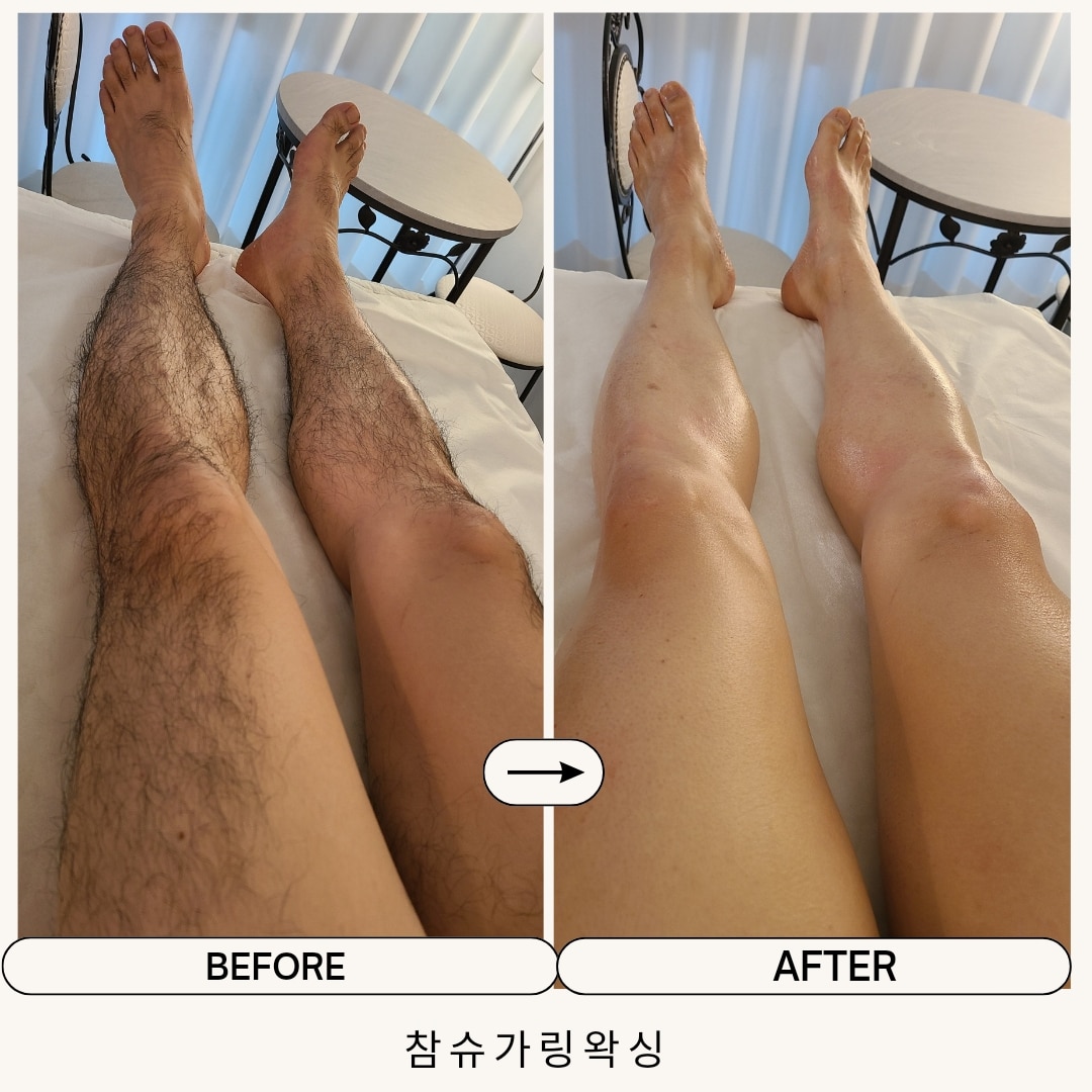 참슈가링왁싱