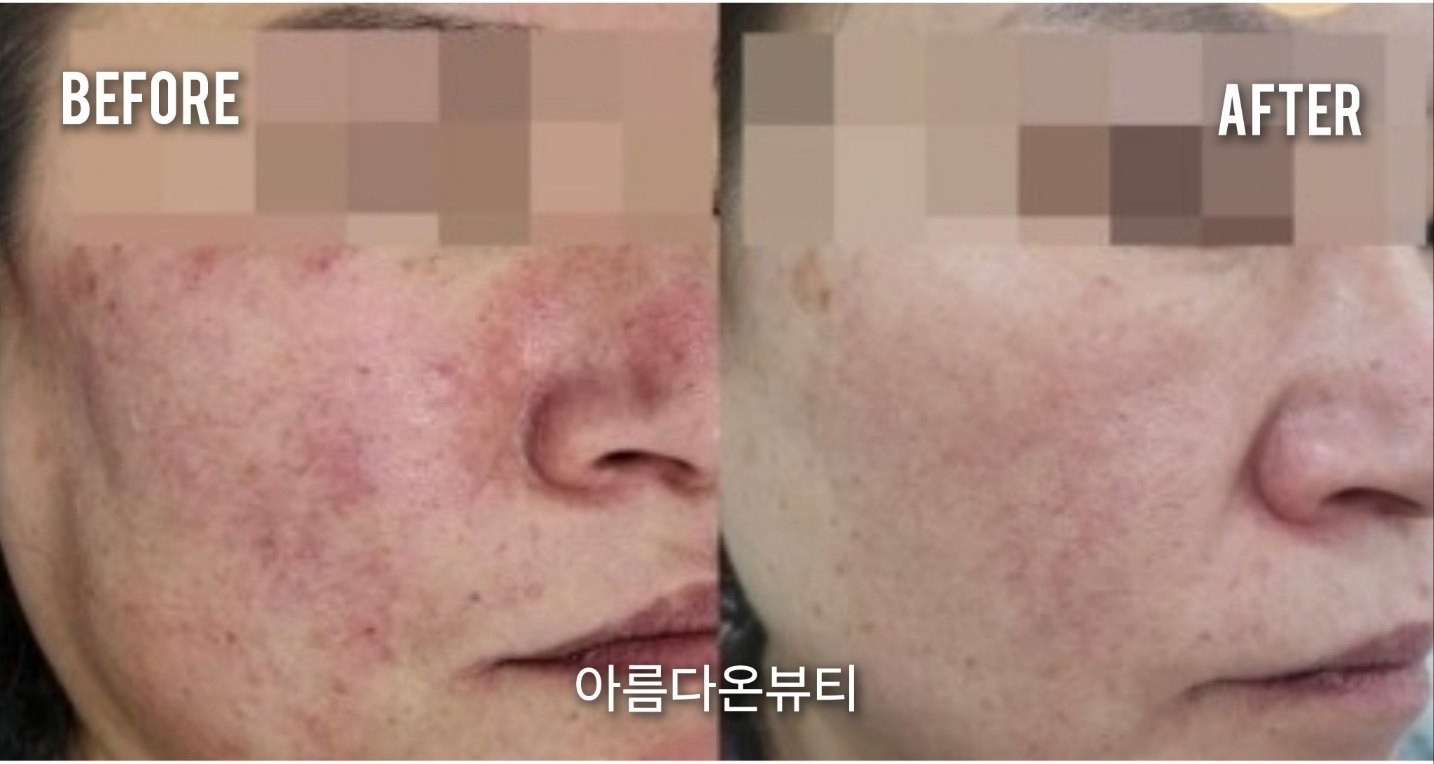 아름다온뷰티