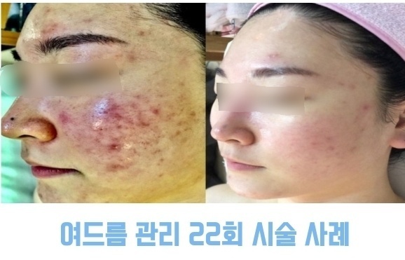 아름다온뷰티