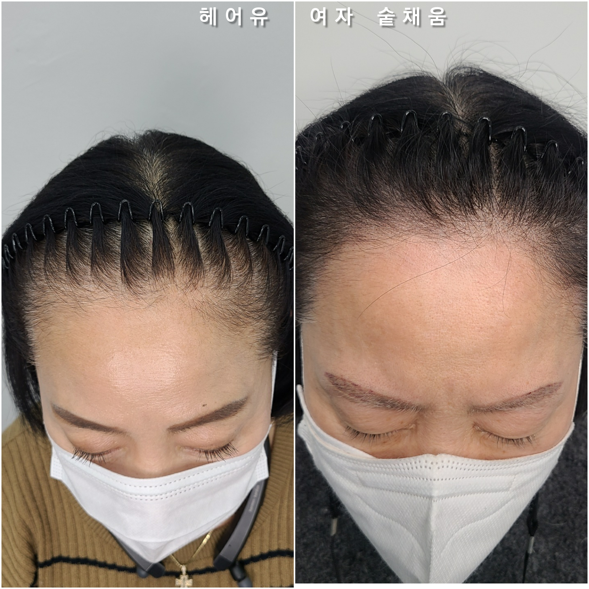 헤어유 대표 이미지