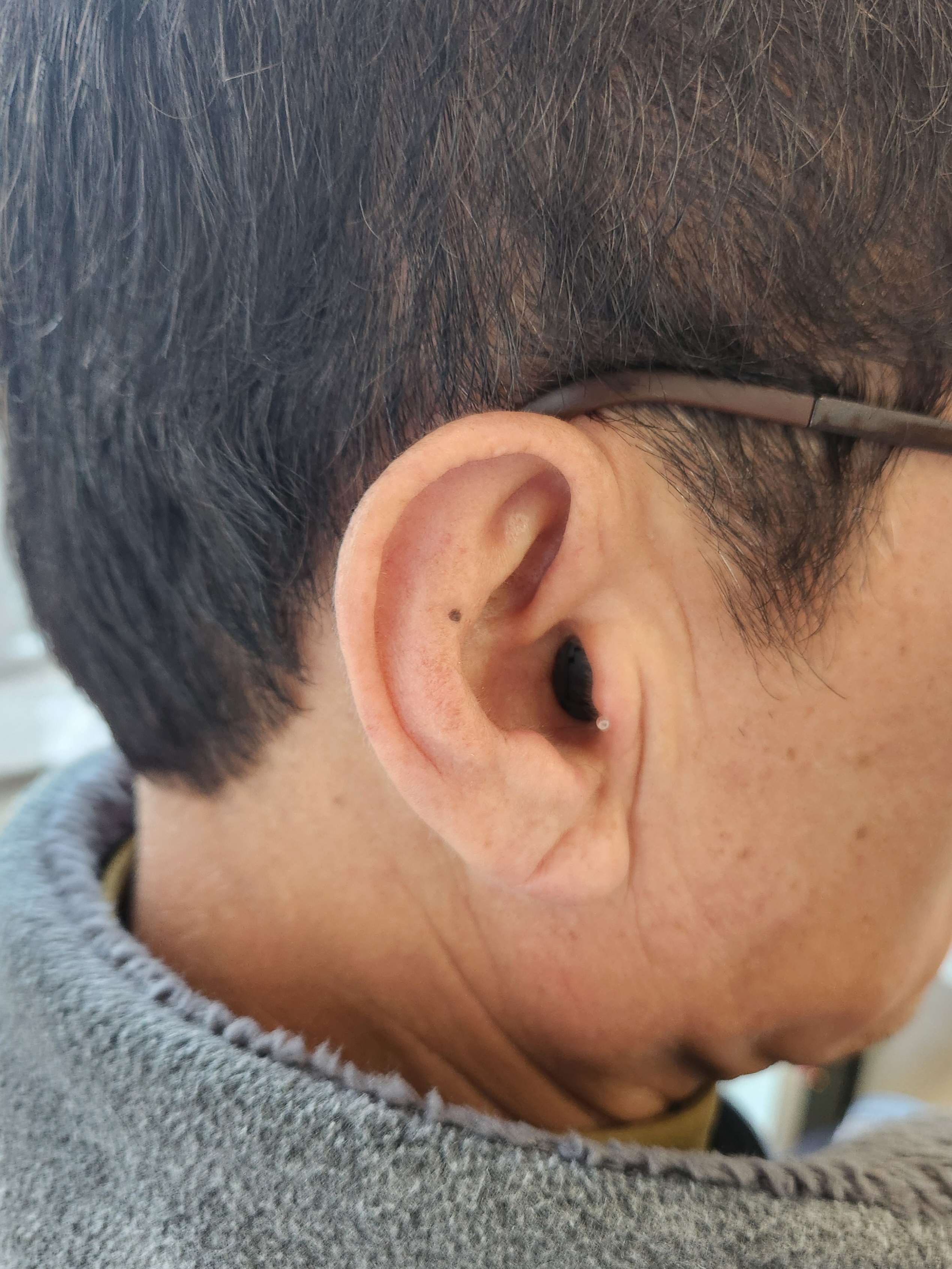 동성보청기 청각센터 대표 이미지