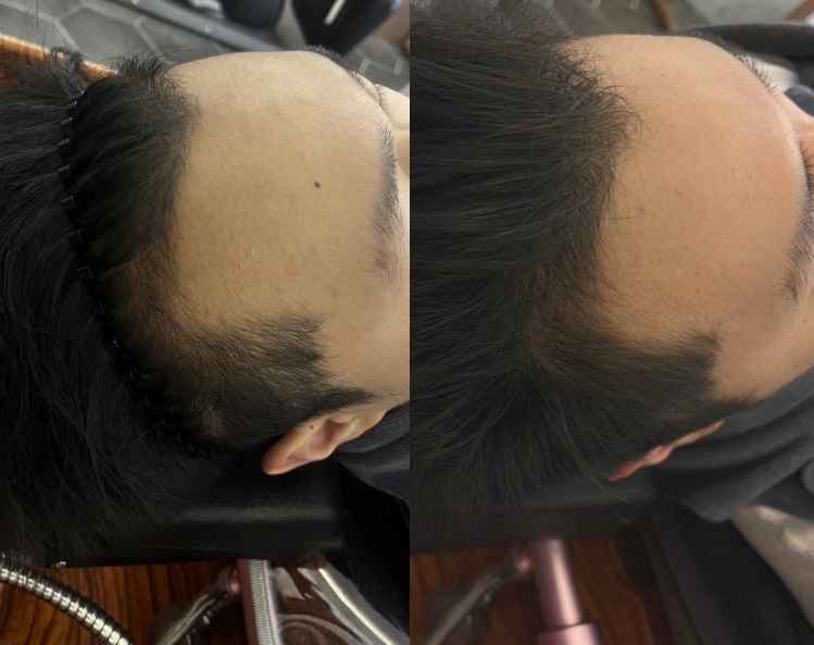 리원스탈모 두피클리닉센터 대표 이미지