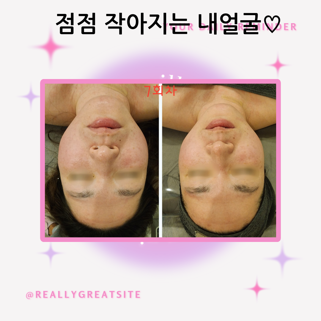 리엔에스테틱