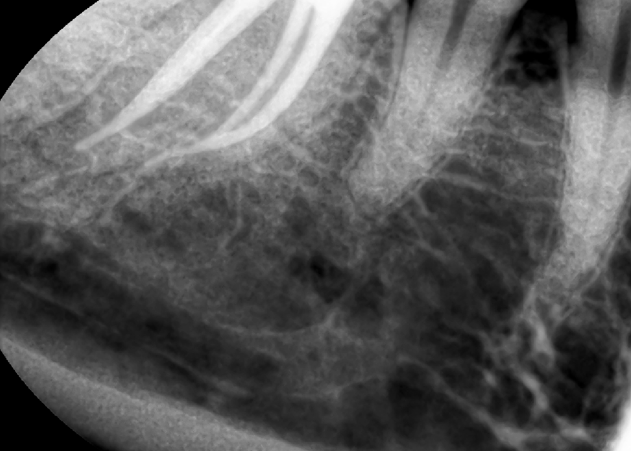 관악이안치과 대표 이미지