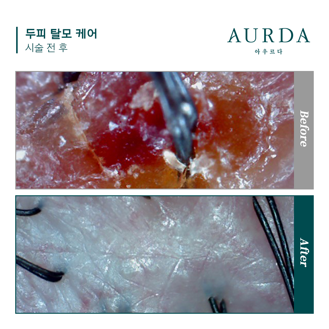 아우르다 대표 이미지