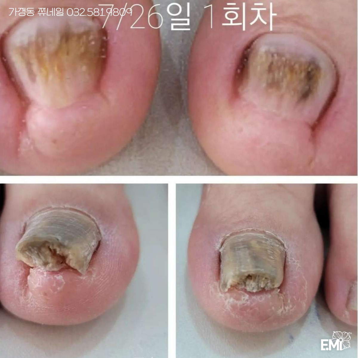 쮸네일