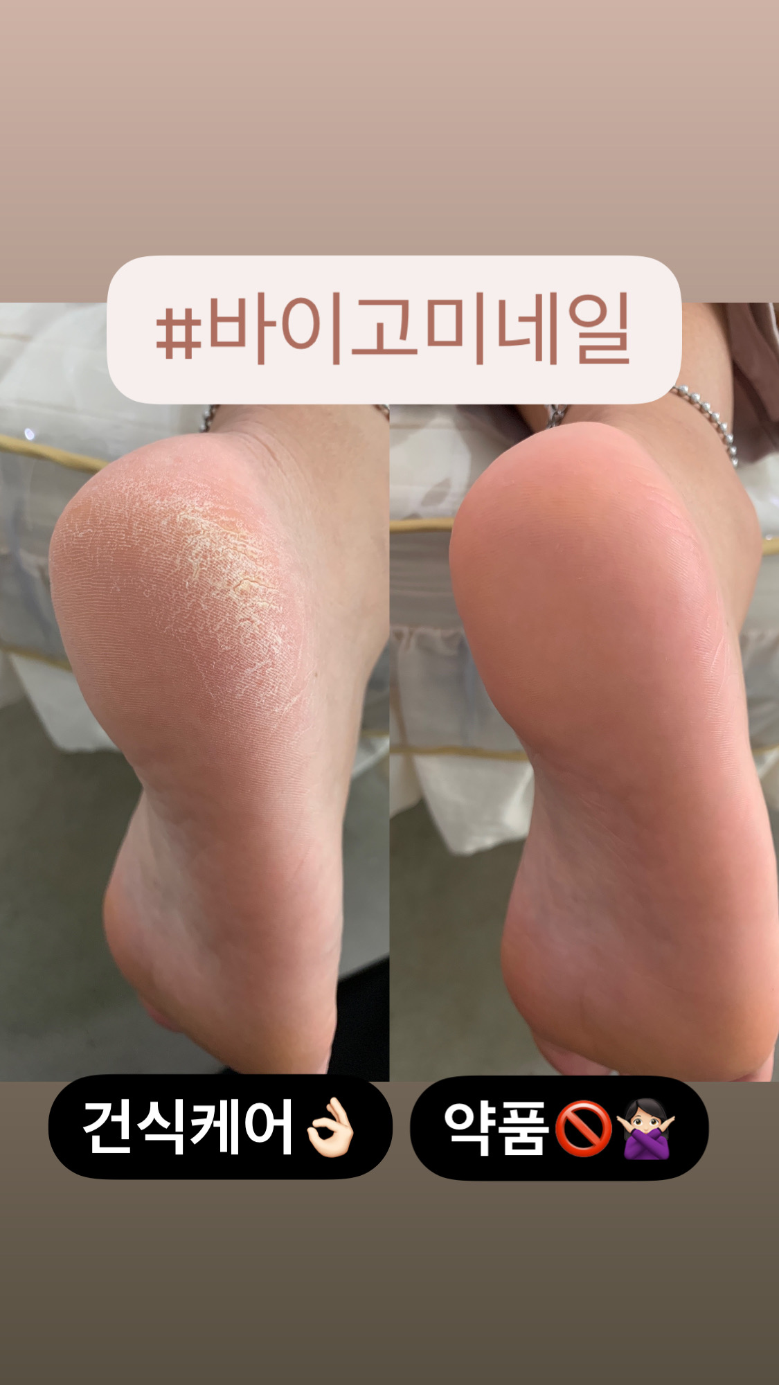 바이고미네일