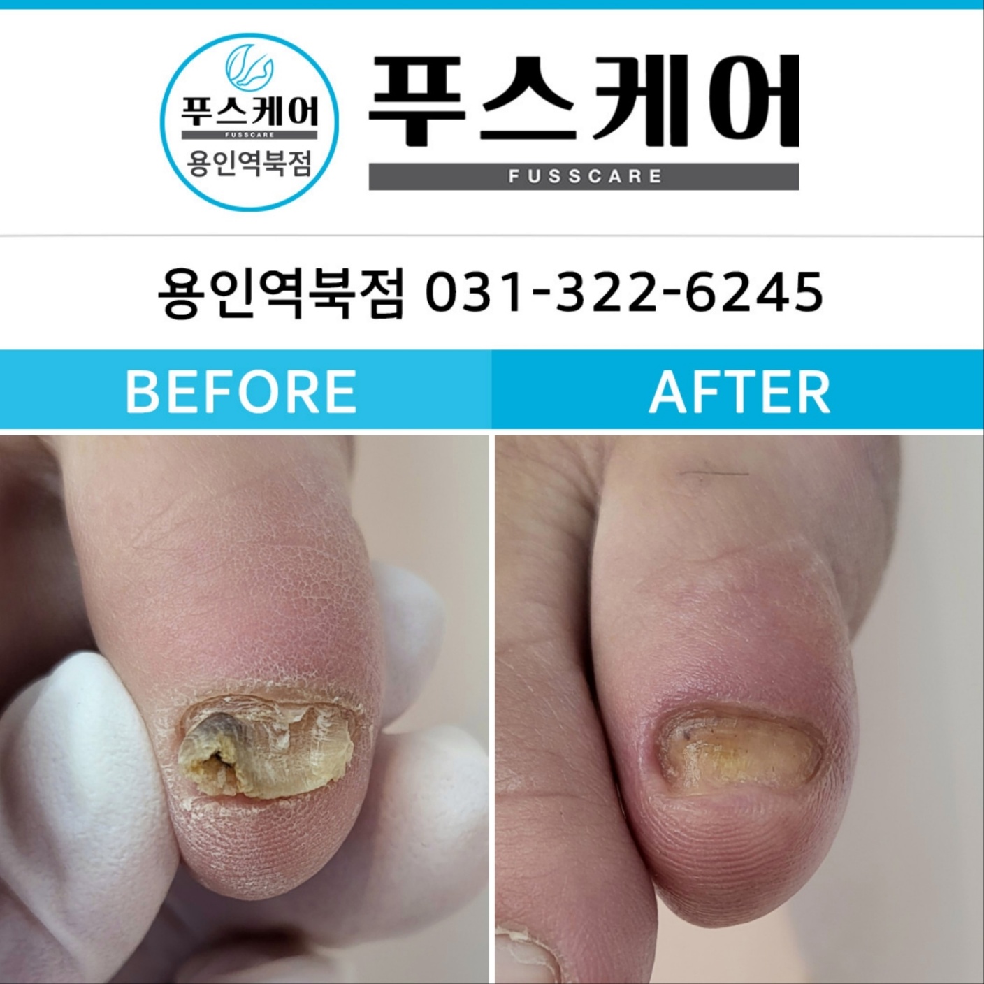 푸스케어 용인역북점