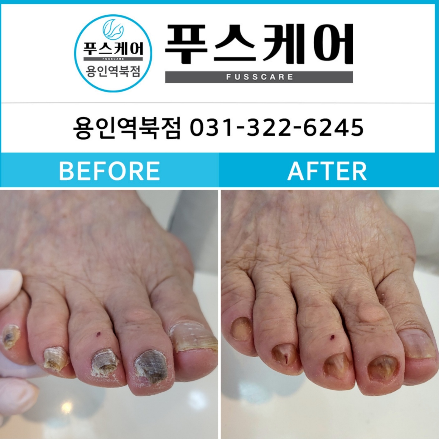 푸스케어 용인역북점