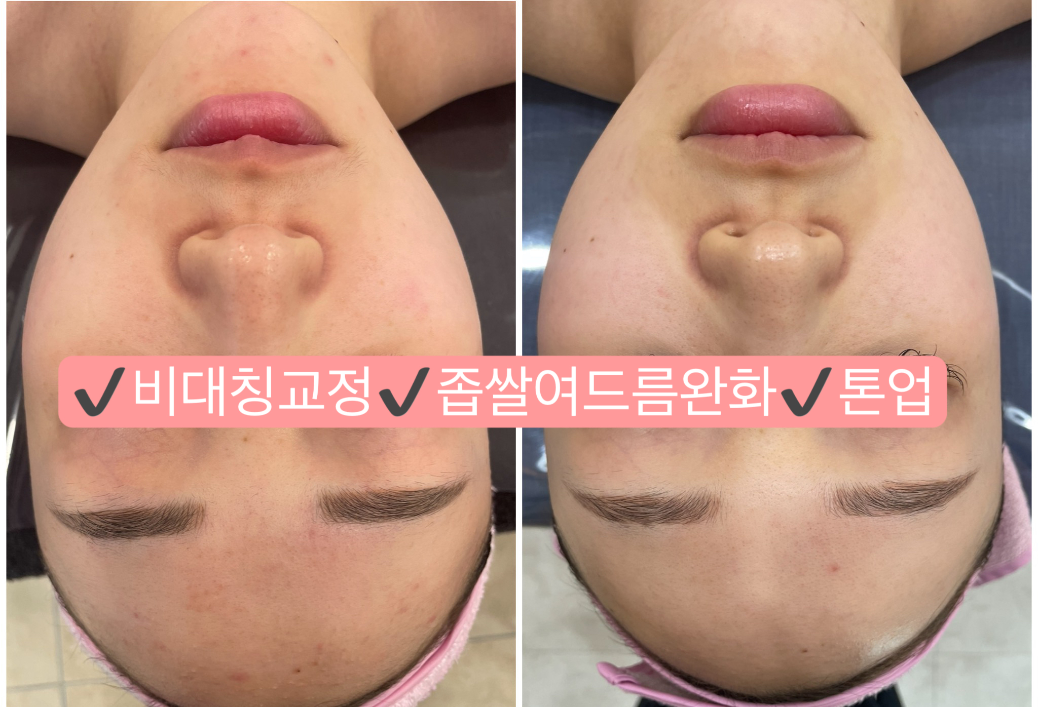 유앤희에스테틱 광주첨단점