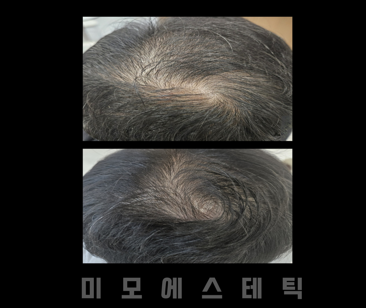 미모에스테틱 대표 이미지