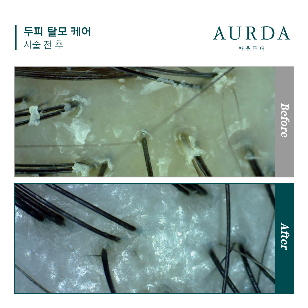 아우르다