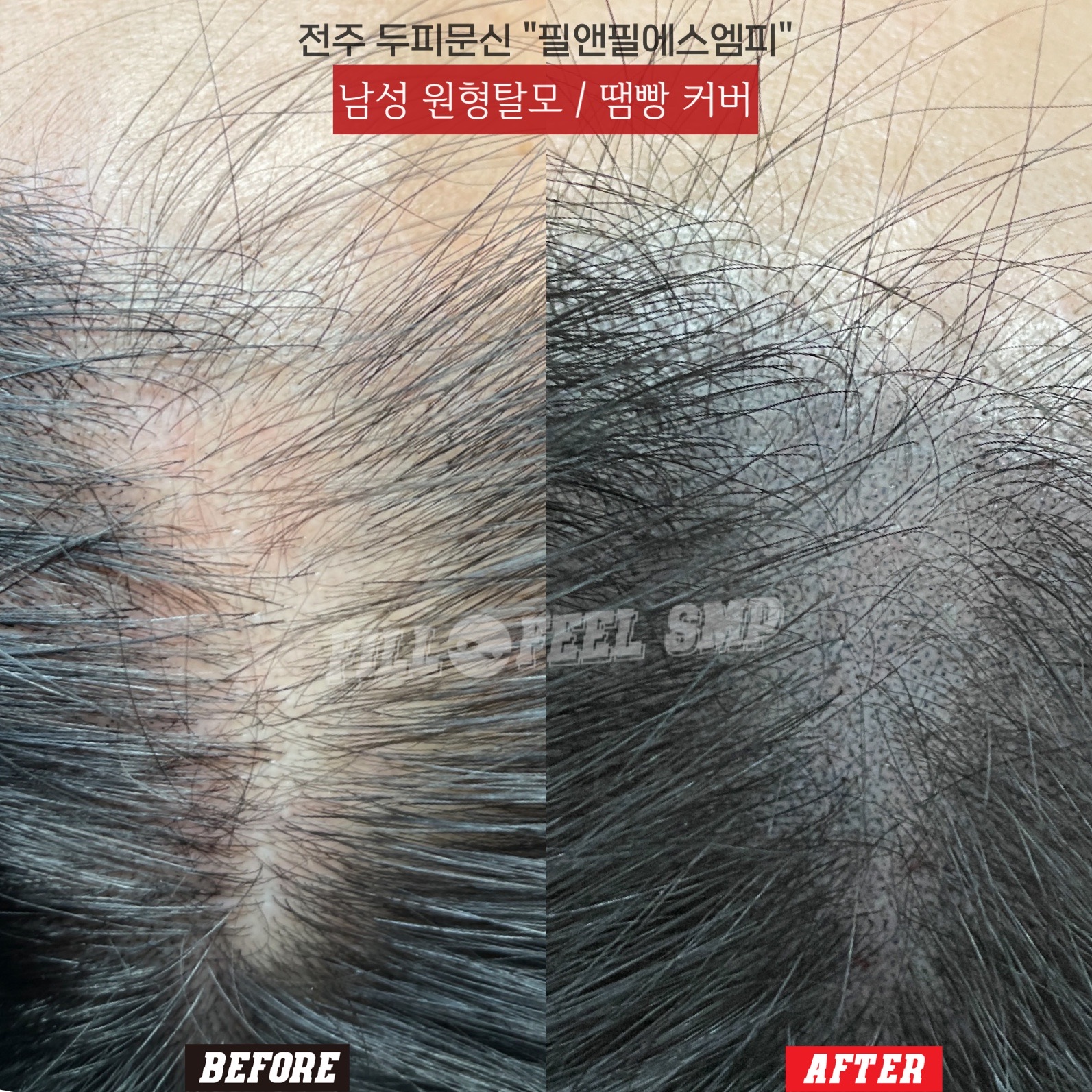 필앤필에스엠피