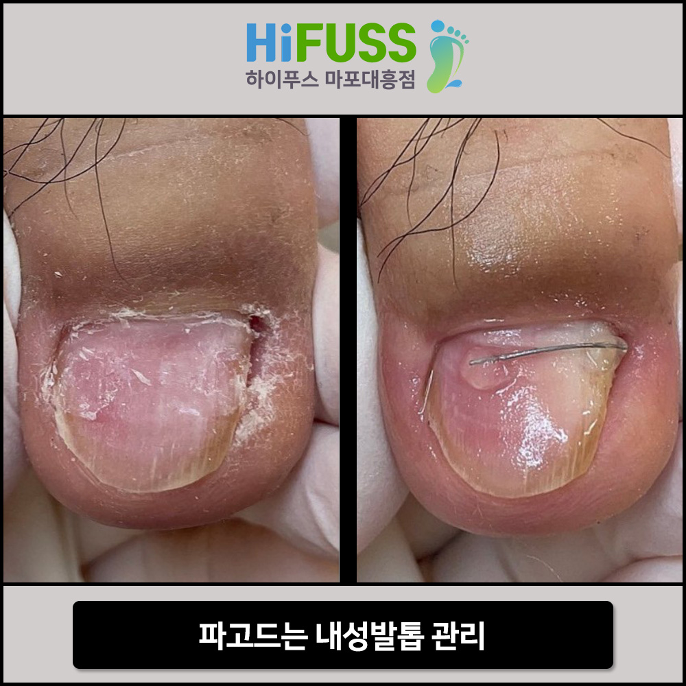 하이푸스 마포대흥점