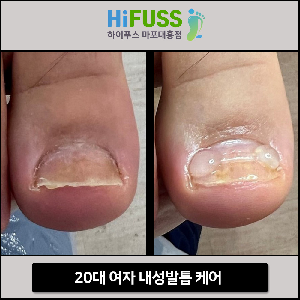 하이푸스 마포대흥점