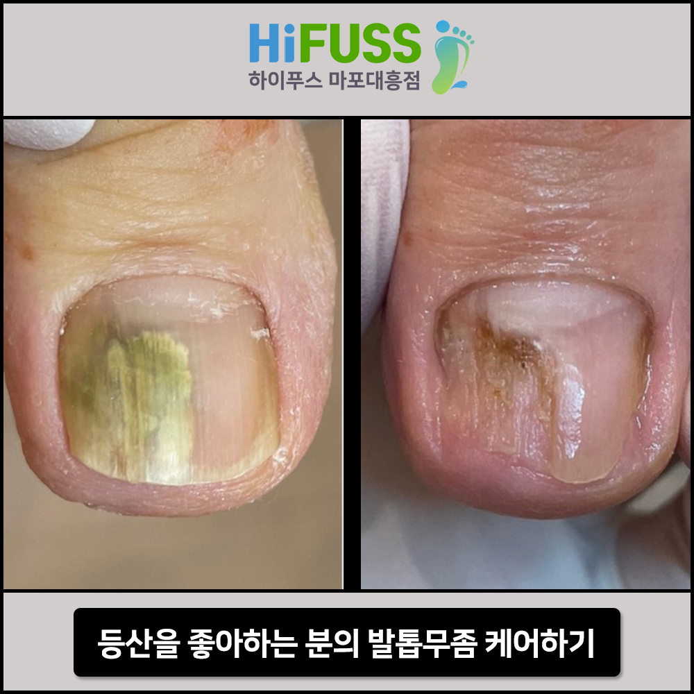 하이푸스 마포대흥점