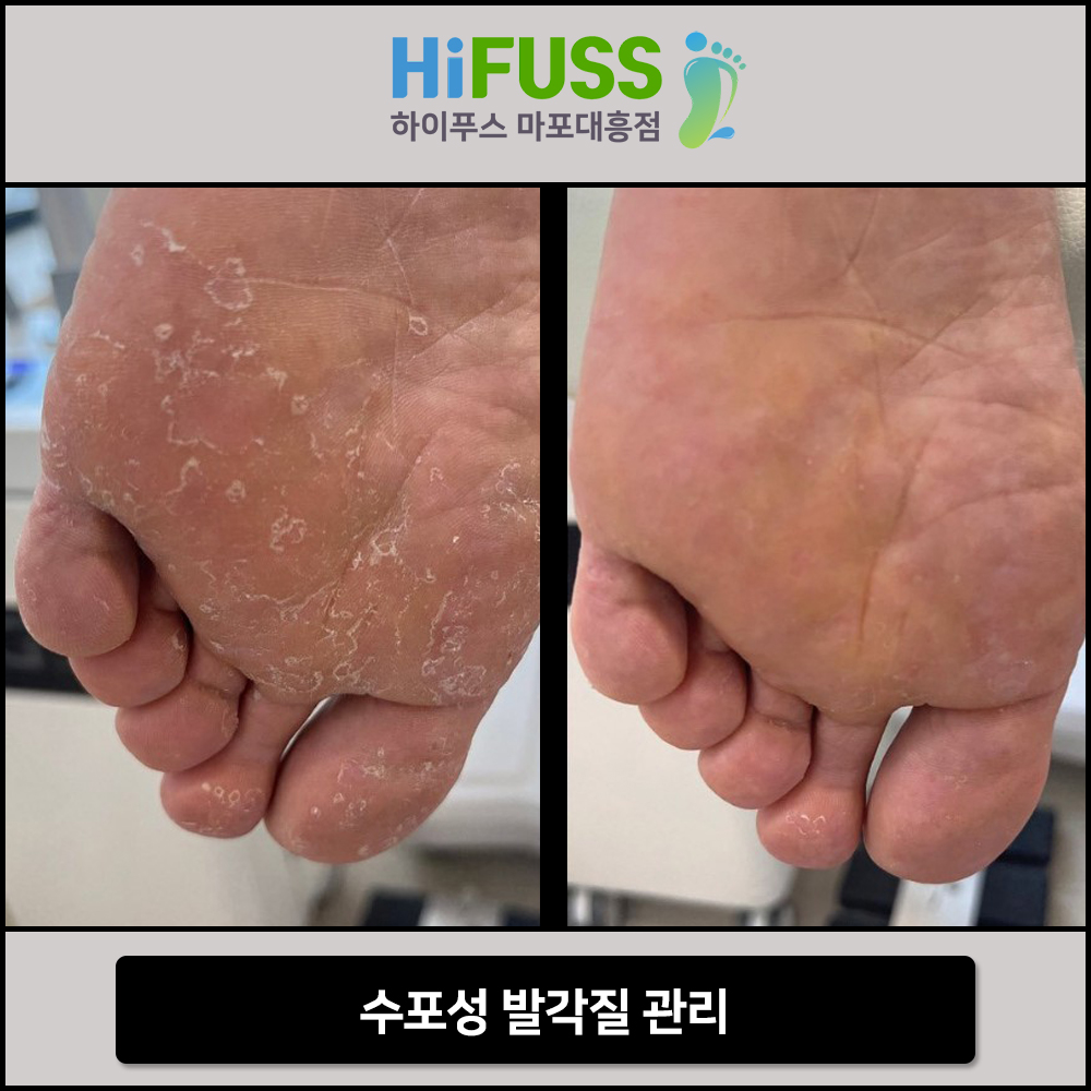 하이푸스 마포대흥점