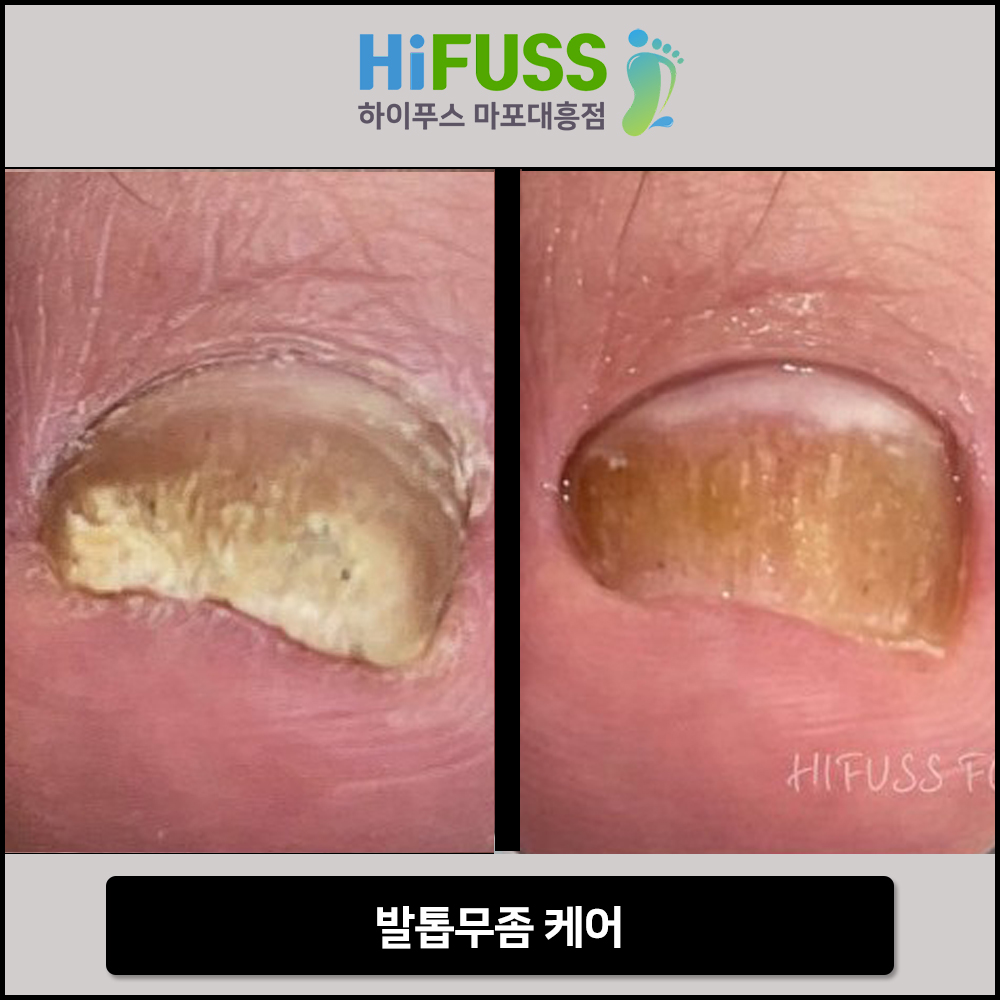 하이푸스 마포대흥점