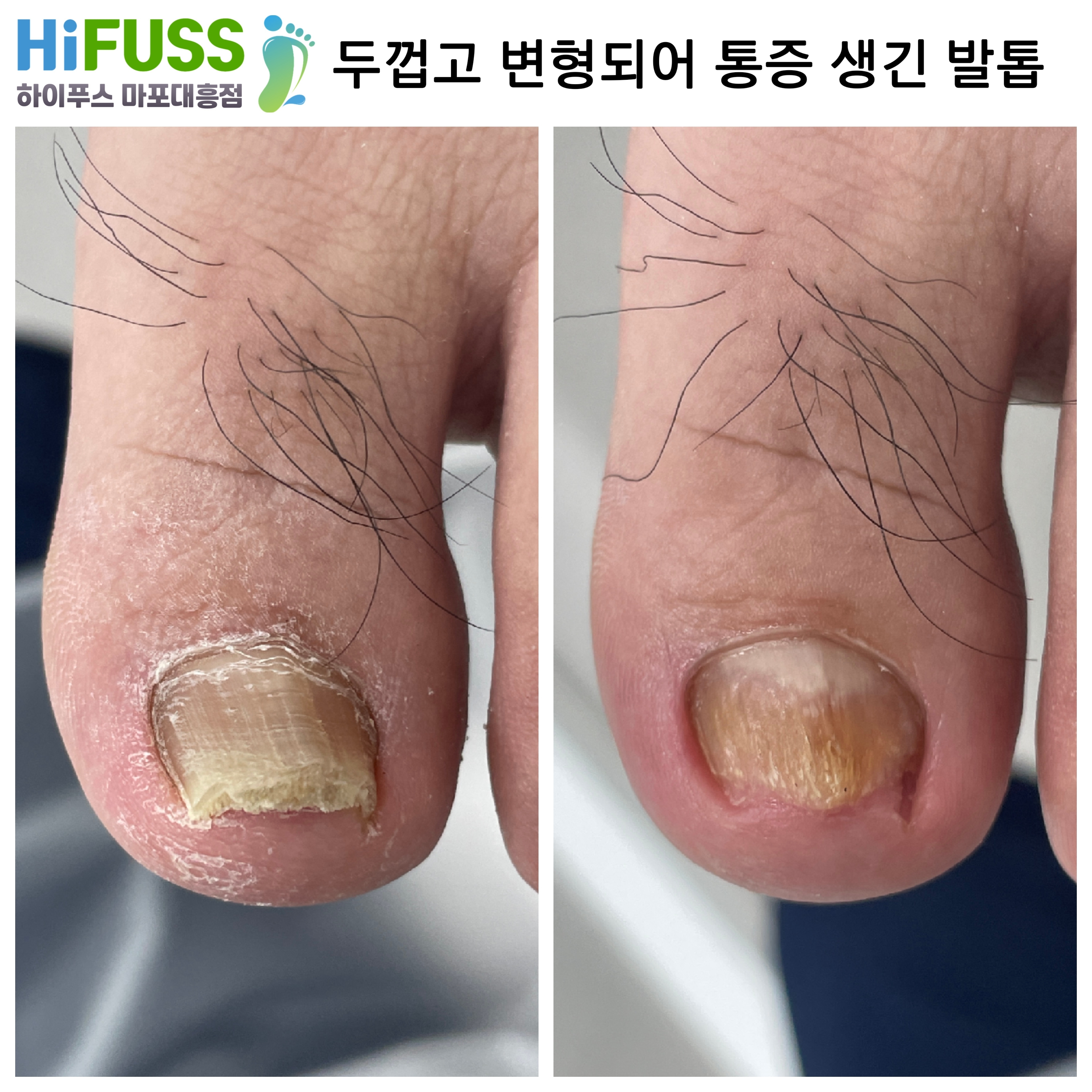 하이푸스 마포대흥점