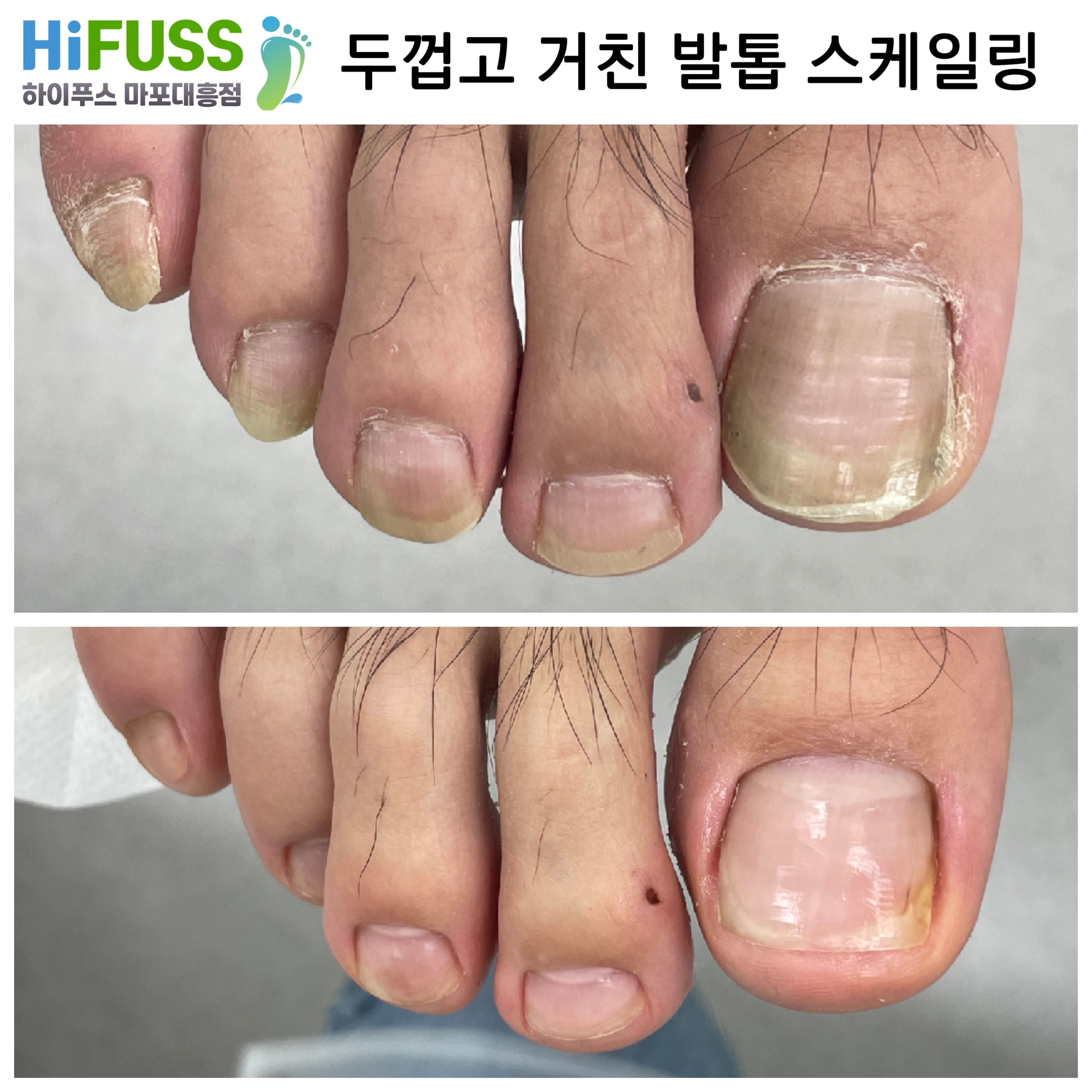 하이푸스 마포대흥점