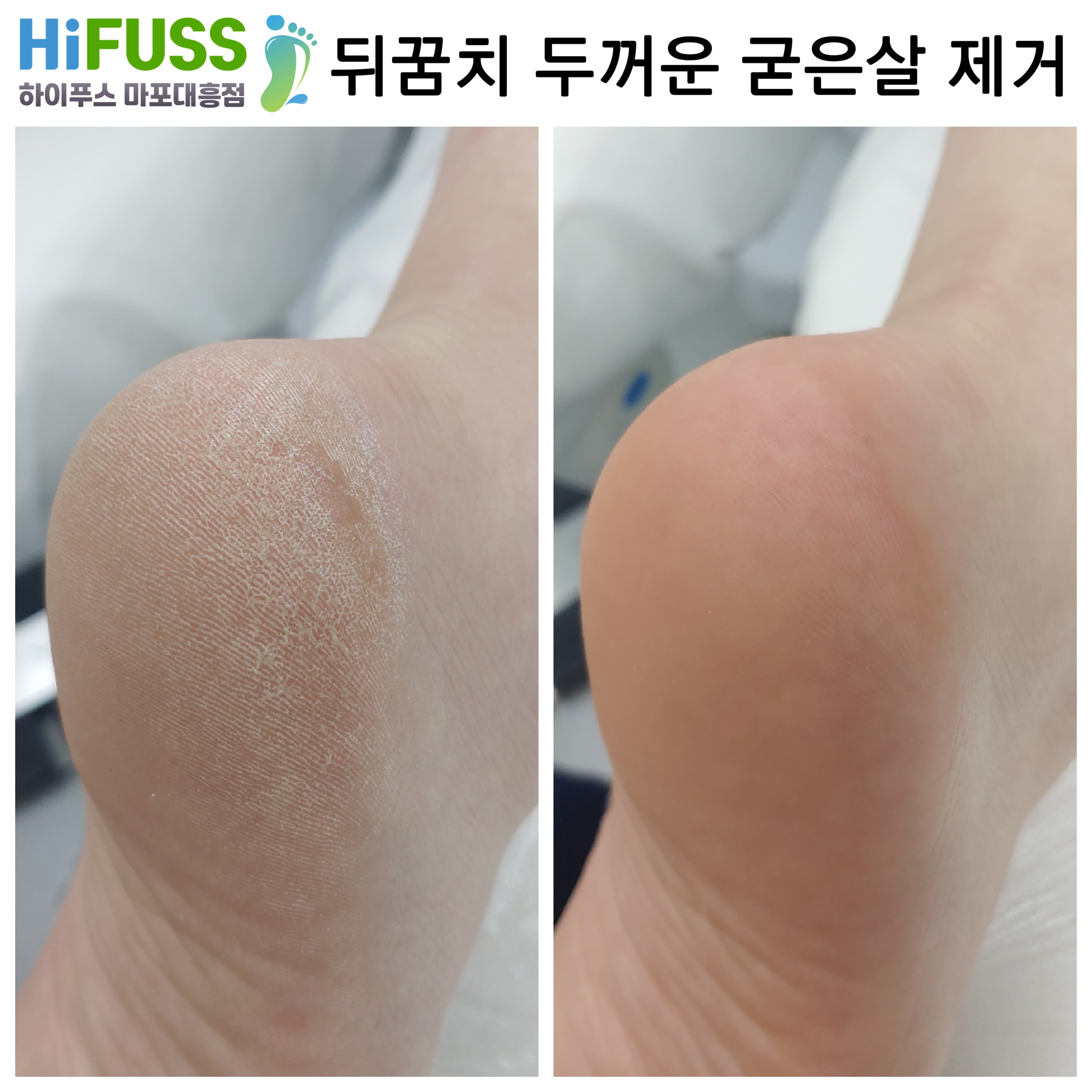 하이푸스 마포대흥점