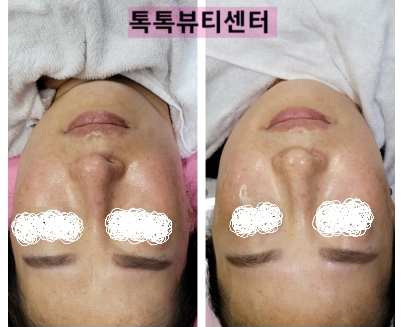 톡톡뷰티 톡톡뷰티센터