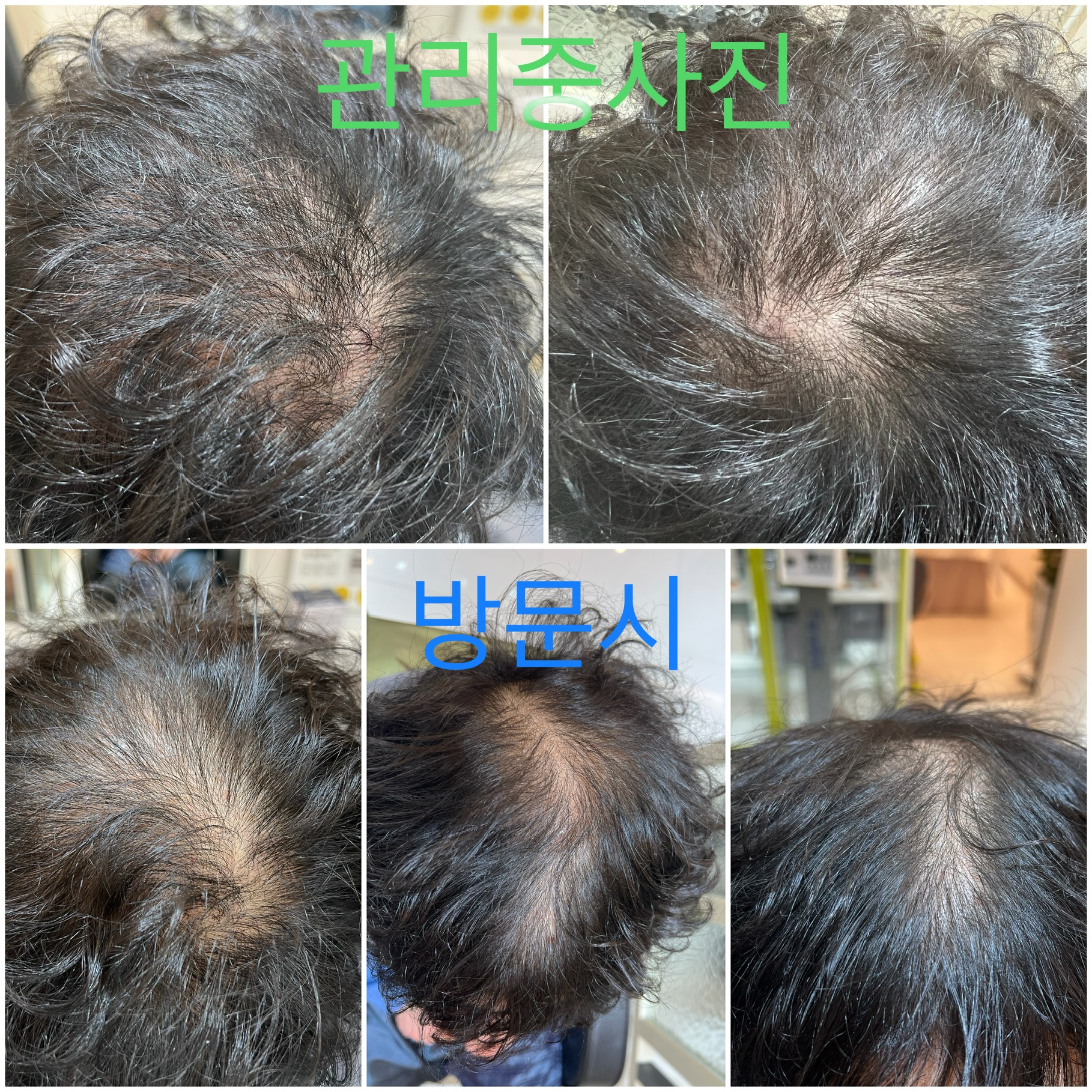 닥터스칼프 원주혁신점