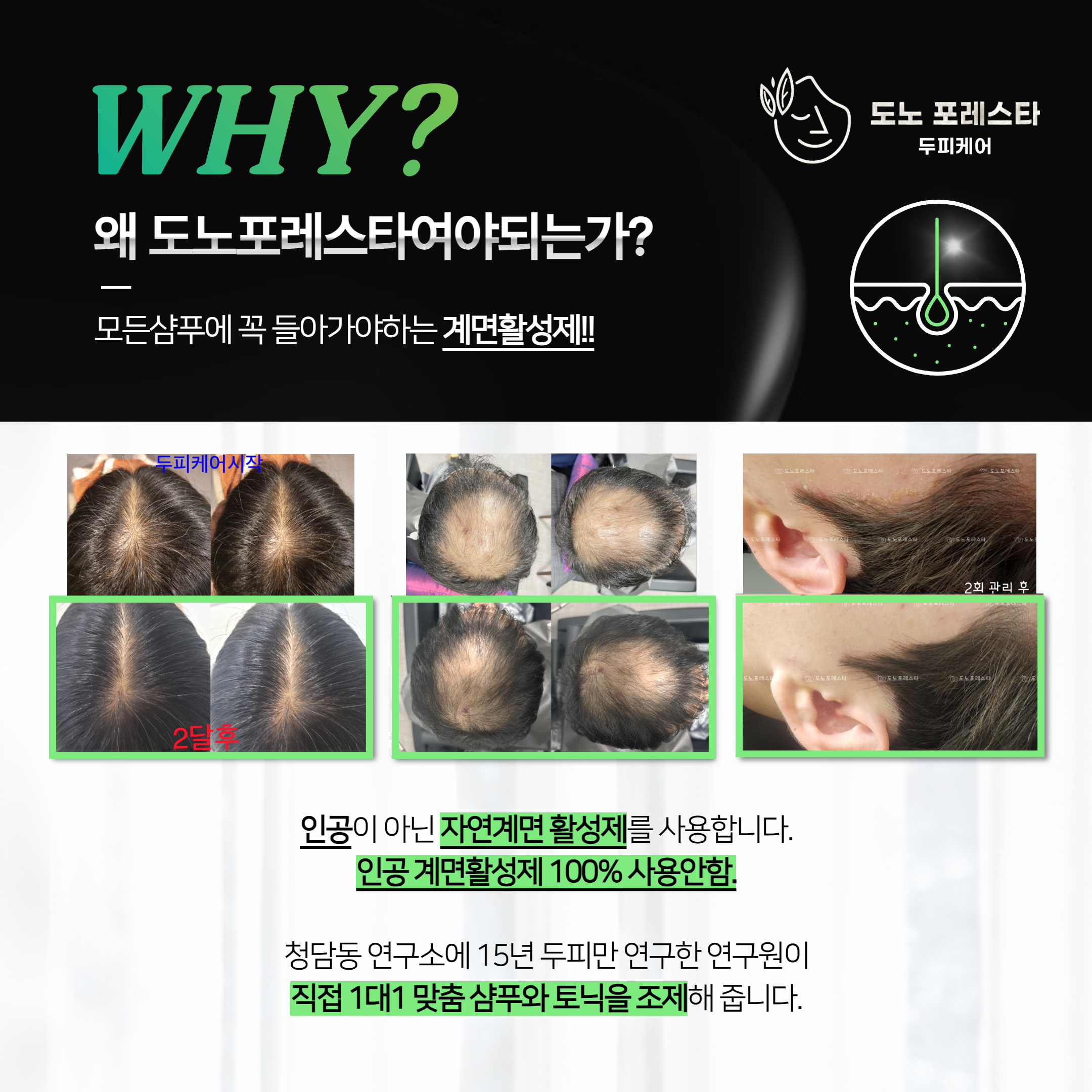 도노포레스타 두피케어 수원광교점