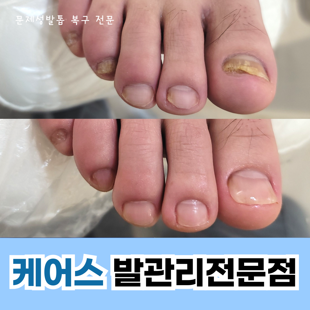 케어스 동래점